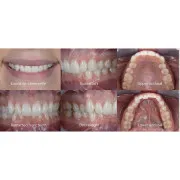 Спалах Godox MF12-DK3