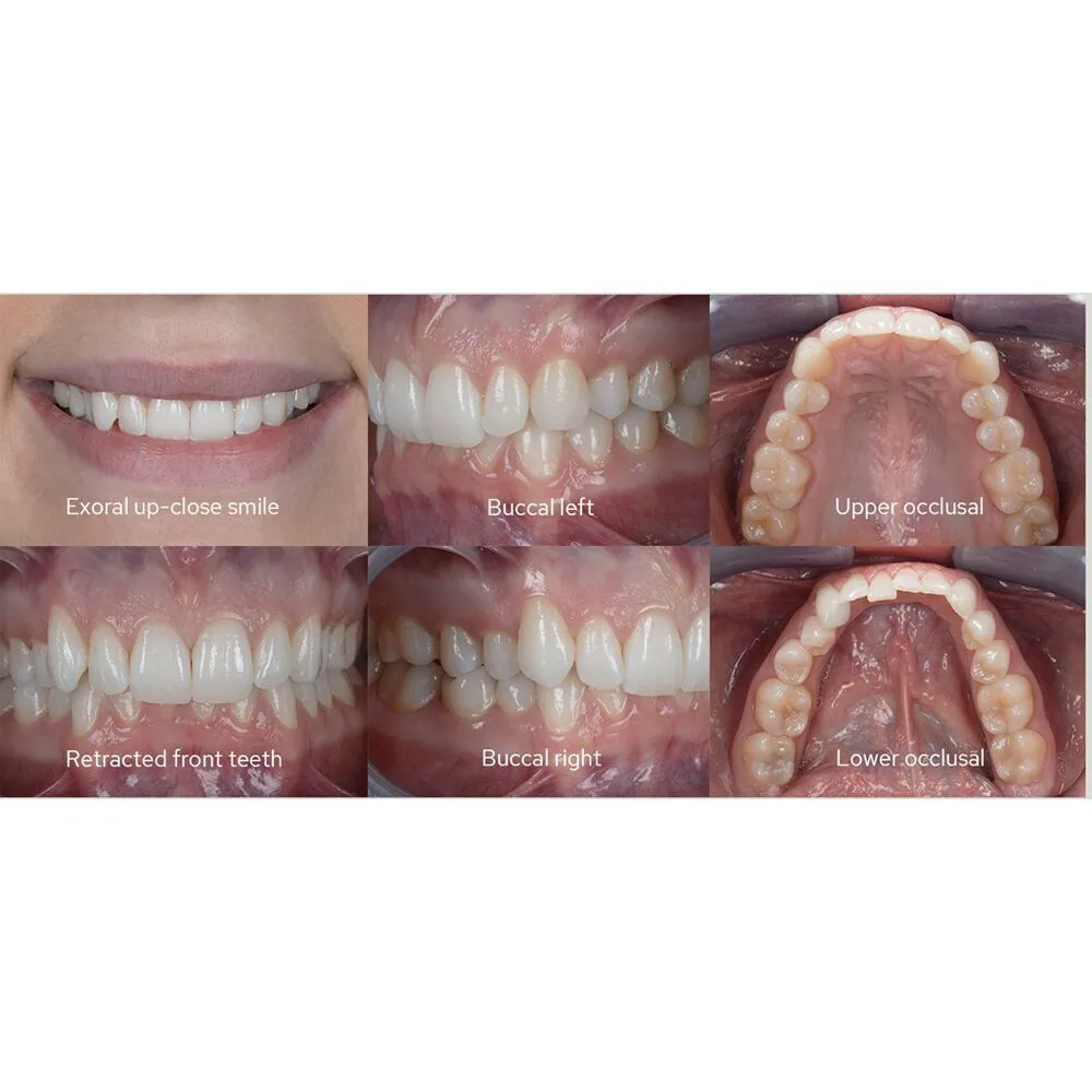 Спалах Godox MF12-DK1